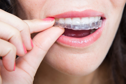 Achieve Teeth Straightening Success in Washington, DC with Invisalign!